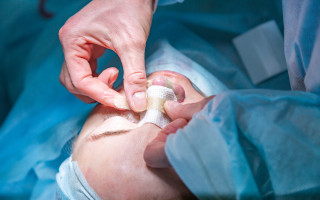 surgeon-his-assistant-performing-cosmetic-surgery-nose-hospital-operating-room-nose-reshaping-augmentation-rhinoplasty
