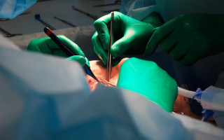 Plastic surgery in operating room