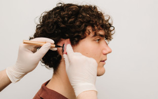 ENT doctor drawing mark up lines before plastic surgery for reshaping ears. Otoplasty surgery markup ear.